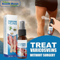 varicose spray