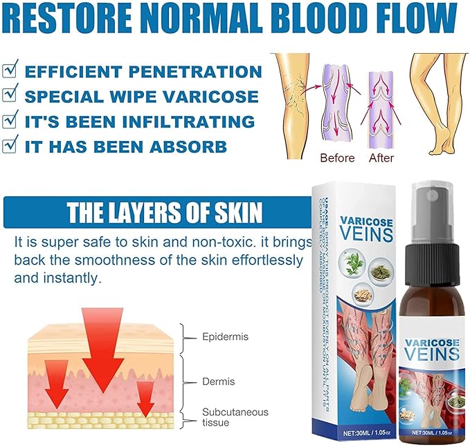 varicose spray