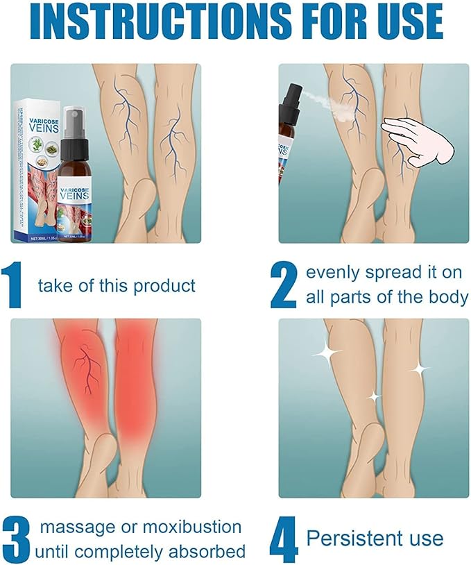 varicose spray